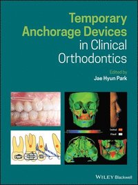 bokomslag Temporary Anchorage Devices in Clinical Orthodontics