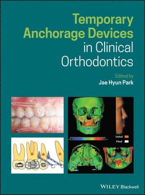 Temporary Anchorage Devices in Clinical Orthodontics 1