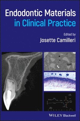 Endodontic Materials in Clinical Practice