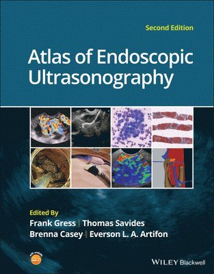 bokomslag Atlas of Endoscopic Ultrasonography