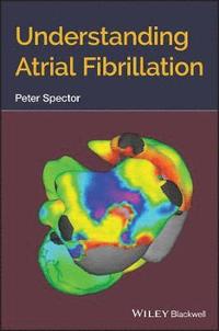 bokomslag Understanding Atrial Fibrillation
