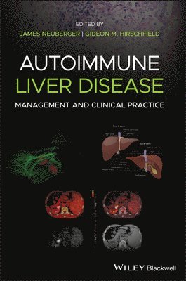 bokomslag Autoimmune Liver Disease