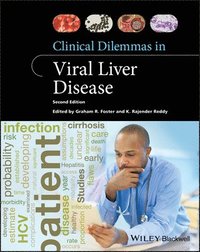 bokomslag Clinical Dilemmas in Viral Liver Disease