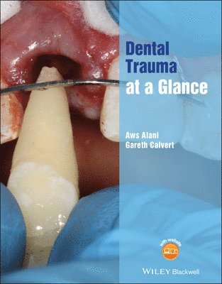 Aws Alani, Gareth Calvert - Dental Trauma at a Glance, Häftad