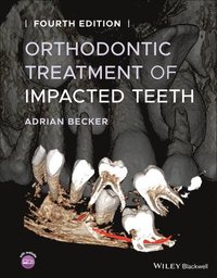 bokomslag Orthodontic Treatment of Impacted Teeth