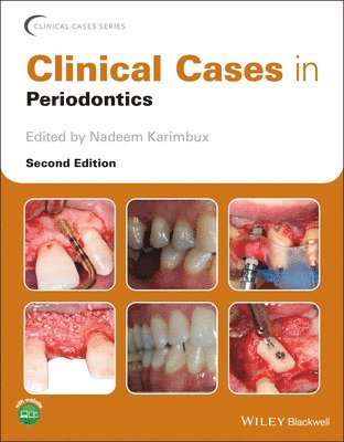 bokomslag Clinical Cases in Periodontics