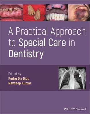 Pedro Diz Dios, Navdeep Kumar - Practical Approach to Special Care in Dentistry, Inbunden