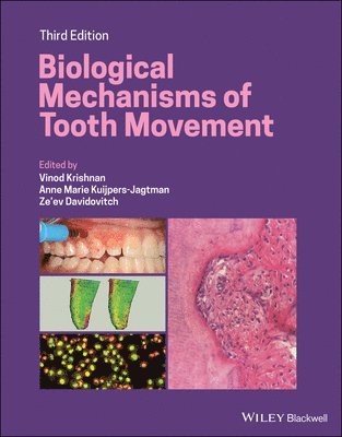 Biological Mechanisms of Tooth Movement 1
