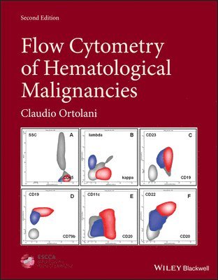 Flow Cytometry of Hematological Malignancies 1