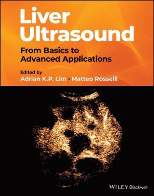 bokomslag Liver Ultrasound