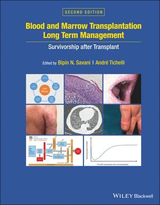 bokomslag Blood and Marrow Transplantation Long Term Management