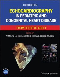 bokomslag Echocardiography in Pediatric and Congenital Heart Disease