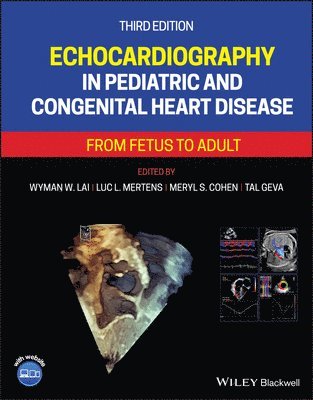 bokomslag Echocardiography in Pediatric and Congenital Heart Disease