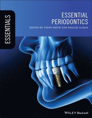 Essential Periodontics 1