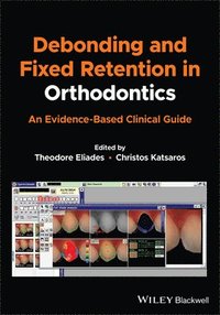 bokomslag Debonding and Fixed Retention in Orthodontics