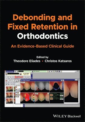 Debonding and Fixed Retention in Orthodontics 1