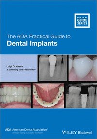 bokomslag The ADA Practical Guide to Dental Implants