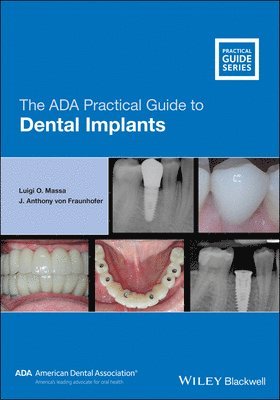 Luigi O. Massa, J. Anthony von Fraunhofer - ADA Practical Guide to Dental Implants, Häftad