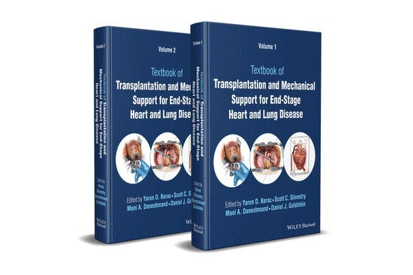 Textbook of Transplantation and Mechanical Support for End-Stage Heart and Lung Disease, 2 Volume Set 1