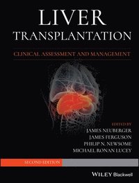 bokomslag Liver Transplantation