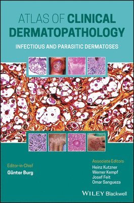 Atlas of Clinical Dermatopathology 1