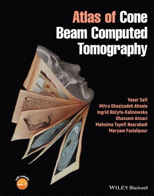 Yaser Safi, Mitra Ghazizadeh Ahsaie, Ingrid Różyło-Kalinowska, Ghassem Ansari, Mahsima Tayefi Nasrabadi, Maryam Fazlalipour - Atlas of Cone Beam Computed Tomography, Inbunden