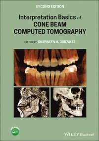 bokomslag Interpretation Basics of Cone Beam Computed Tomography