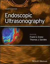 bokomslag Endoscopic Ultrasonography