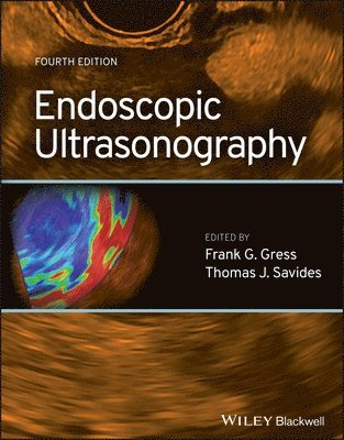 Endoscopic Ultrasonography 1