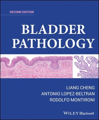 Liang Cheng, Antonio Lopez-Beltran, Rodolfo Montironi - Bladder Pathology, Inbunden