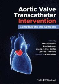 bokomslag Aortic Valve Transcatheter Intervention