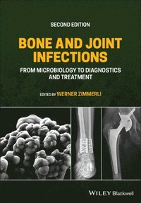 bokomslag Bone and Joint Infections