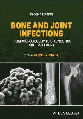 Bone and Joint Infections 1