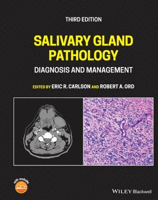 bokomslag Salivary Gland Pathology