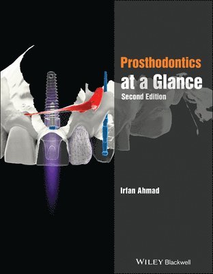 Irfan Ahmad - Prosthodontics at a Glance, Häftad