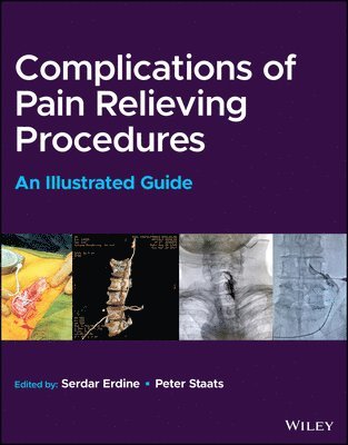 bokomslag Complications of Pain-Relieving Procedures