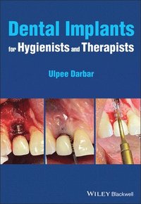 bokomslag Dental Implants for Hygienists and Therapists