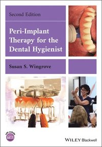 bokomslag Peri-Implant Therapy for the Dental Hygienist