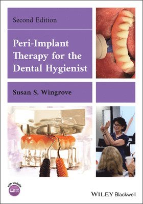 Peri-Implant Therapy for the Dental Hygienist 1