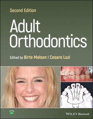 Birte Melsen, Cesare Luzi, Denmark) Melsen, Birte (Royal Dental College, Univerity of Aarhus, Cesare (European Postgraduate Students Orthodontic Society (EPSOS)) Luzi - Adult Orthodontics, Inbunden