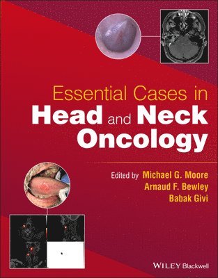 bokomslag Essential Cases in Head and Neck Oncology