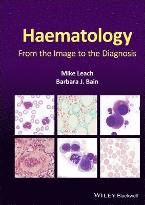 bokomslag Haematology