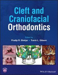 bokomslag Cleft and Craniofacial Orthodontics
