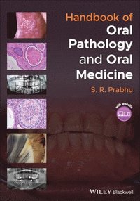 bokomslag Handbook of Oral Pathology and Oral Medicine