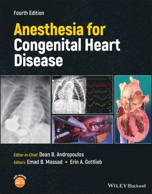 Anesthesia for Congenital Heart Disease 1
