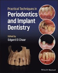 bokomslag Practical Techniques in Periodontics and Implant Dentistry