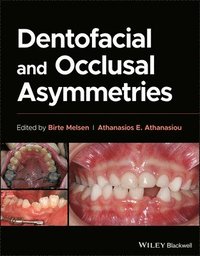 bokomslag Dentofacial and Occlusal Asymmetries