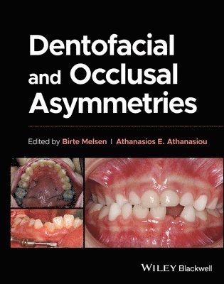 bokomslag Dentofacial and Occlusal Asymmetries