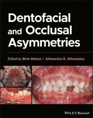 Dentofacial and Occlusal Asymmetries 1