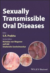bokomslag Sexually Transmissible Oral Diseases